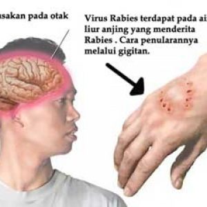 Ilustrasi gigitan penyakit rabies